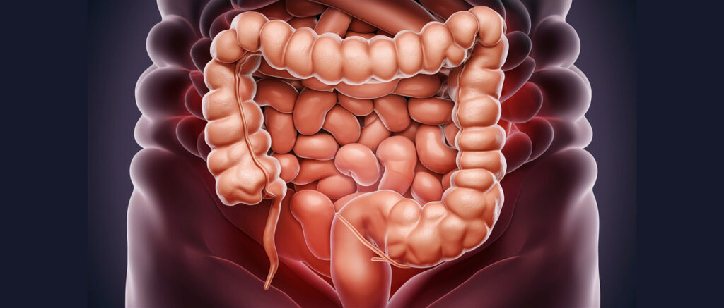 colon, anatomy, medical, sistema digestivo, intestino delgado, ai generated, colon, colon, colon, colon, colon, medical-8804708.jpg